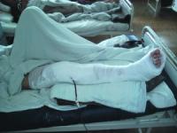 Incepe sezonul fracturilor!