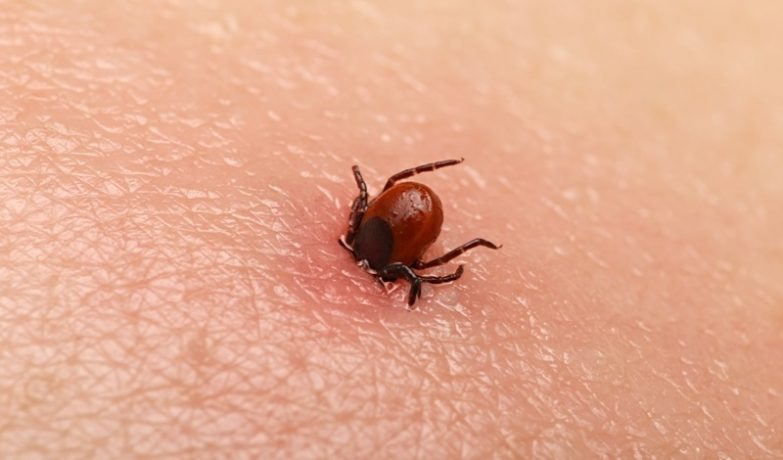 Profilaxia bolii Lyme după mușcătura de căpușă